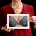 Singhvi Online Breast Cancer