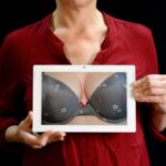 Singhvi Online Breast Cancer